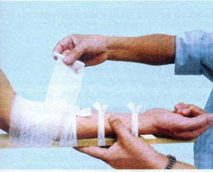 Bộ Băng Bó Cho Người Gãy Xương Tay, Xương Chân 6 Bộ Băng Bó Cho Người Gãy Xương Tay, Xương Chân